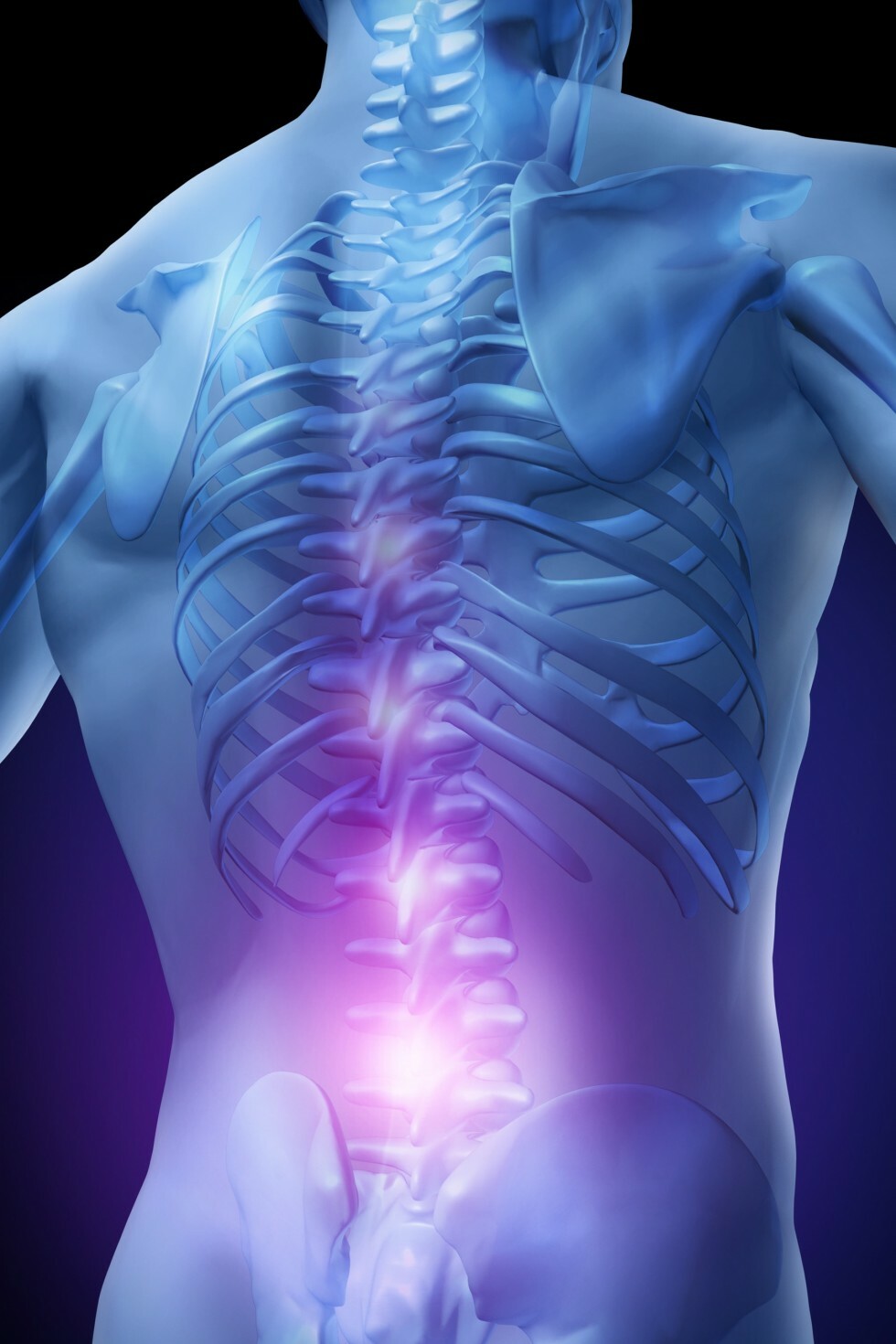 model of back pain